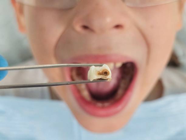 Best Emergency Dentist for Special Needs Patients in Old Mystic, CT